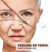 banner-peeeling-fenol-ziper-mobile-12junho2023
